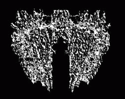 logo Carcinomas Of Unknown Primary Origin